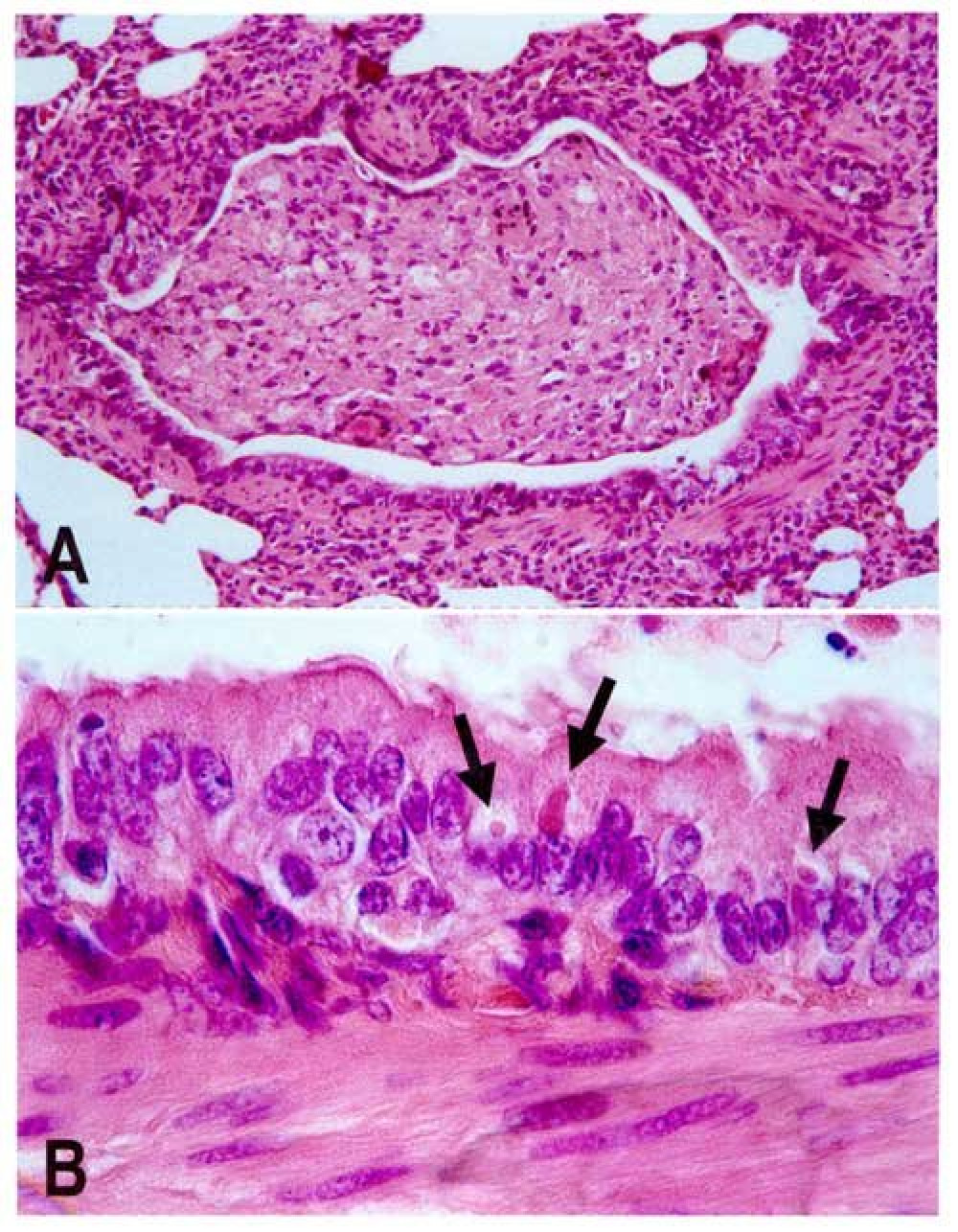 Canine_distemper_pathology